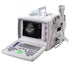 US9618 Portable Ultrasound Scanner with Convex Probe